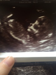 December 2017 babies #6 - dating scans, gender reveals, the beginning of bumps & the 2nd trimester!