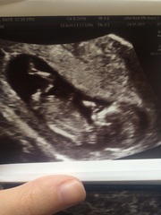 December 2017 babies #6 - dating scans, gender reveals, the beginning of bumps & the 2nd trimester!