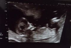 December 2017 babies #6 - dating scans, gender reveals, the beginning of bumps & the 2nd trimester!