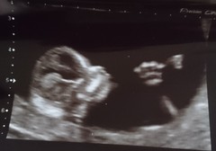 December 2017 babies #6 - dating scans, gender reveals, the beginning of bumps & the 2nd trimester!