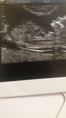 gender guesses please 😘