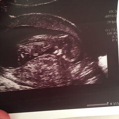 December 2017 babies #6 - dating scans, gender reveals, the beginning of bumps & the 2nd trimester!