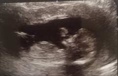 December 2017 babies #6 - dating scans, gender reveals, the beginning of bumps & the 2nd trimester!