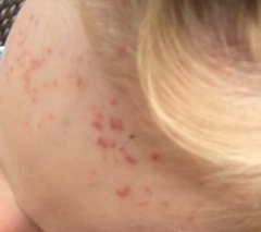 Mystery rash GP stumped