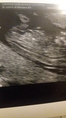gender guesses please 😘