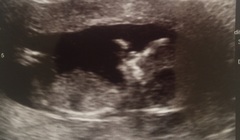 December 2017 babies #6 - dating scans, gender reveals, the beginning of bumps & the 2nd trimester!