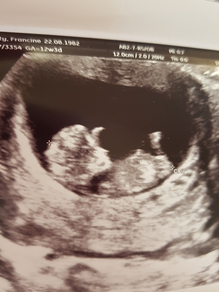 12 week scan went well! help me guess??