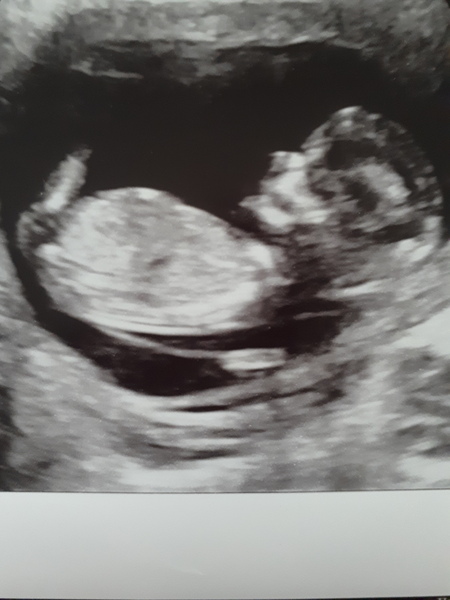 February 2018 Babies #2