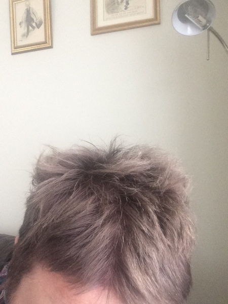Manage to dye my hair salt and pepper so transitioning from dark will be a breeze.