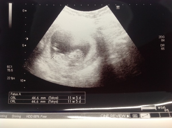 February 2018 Babies #2