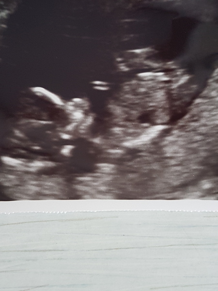 Gender guesses?
