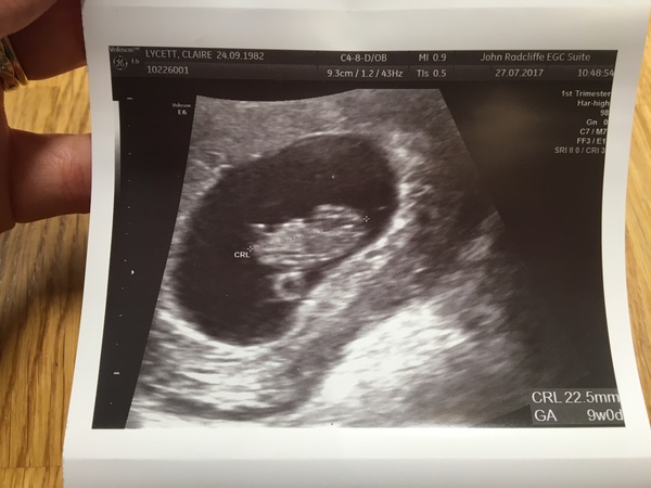 Anyone just found out they're preggers and want some buddies?