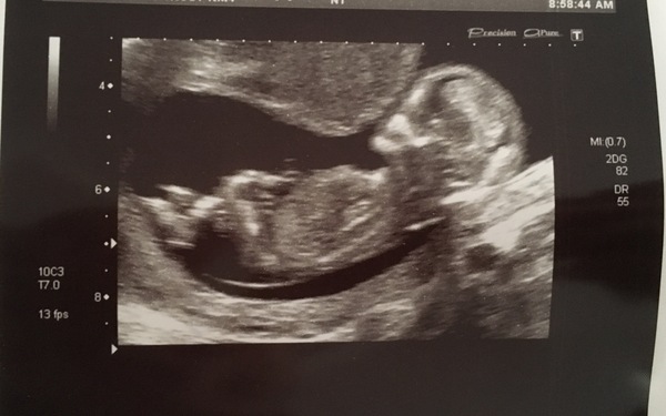First Time Pregnancy (3)