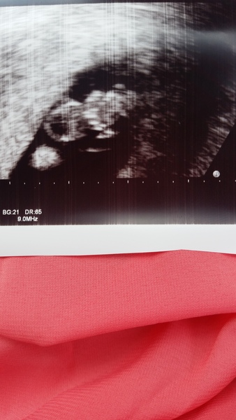 8weeks