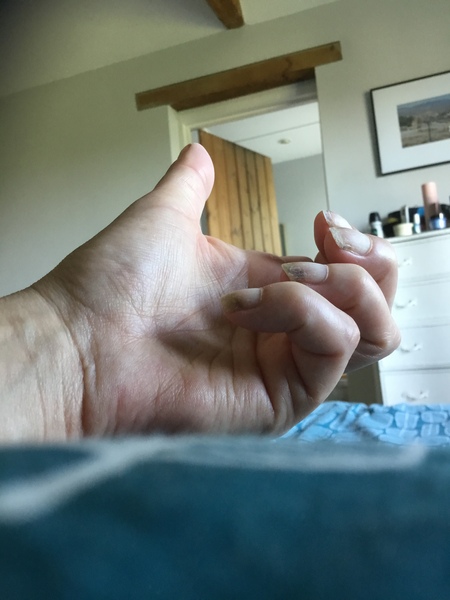 WHAF is wrong with my nails?