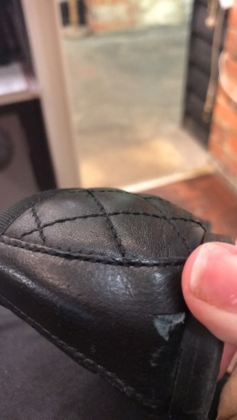 Faulty shoes or expected wear and tear