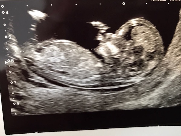 February 2018 Babies #2