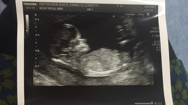 February 2018 Babies #2