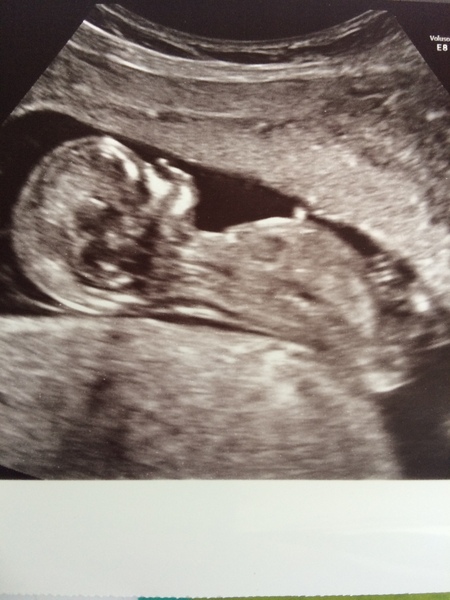 February 2018 Babies #2