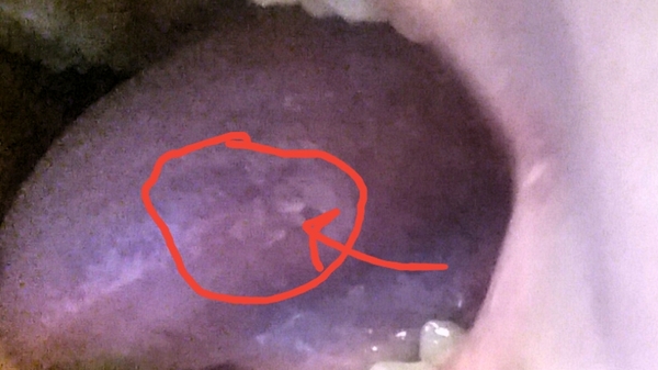 Long lasting mouth ulcer thing