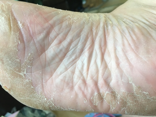 Footner - day 4