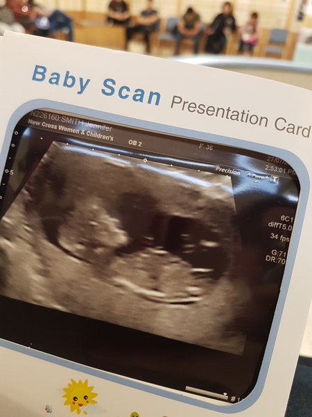 February 2018 Babies #2