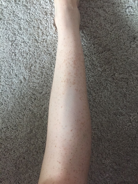What's up with the skin on my leg? (photo)