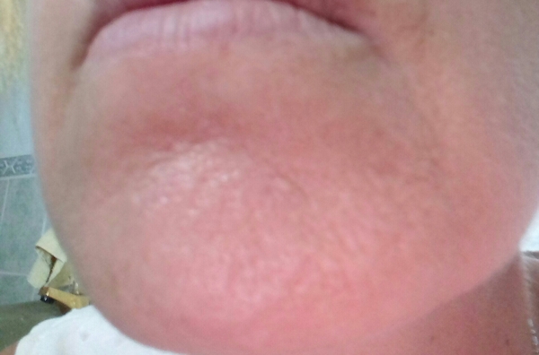 Fantastic Skincare: Skin (almost) sorted- decent fucking summer fucking clothes would be fucking nice. Don't ask us about our hair 🐌