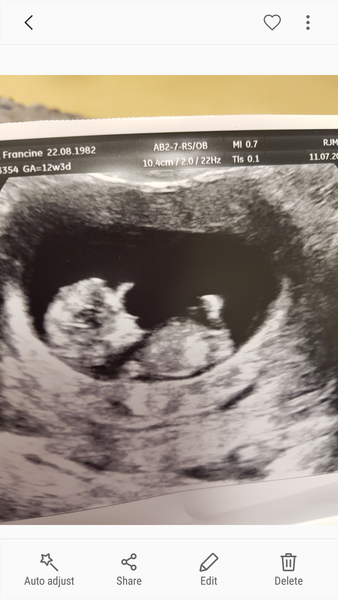 12 week scan this week. Anyone else?