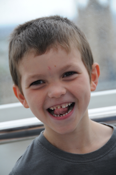 3 yo knocked mouth- wobbly tooth