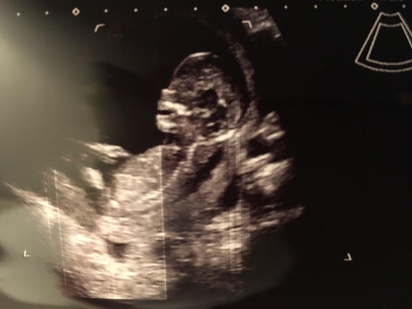 February 2018 Babies #2