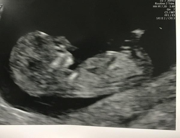 February 2018 Babies #2