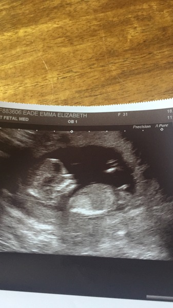 February 2018 Babies #2