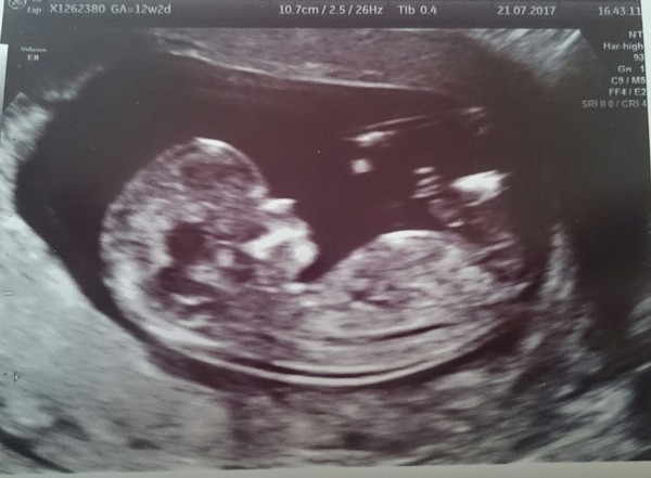 February 2018 Babies #2