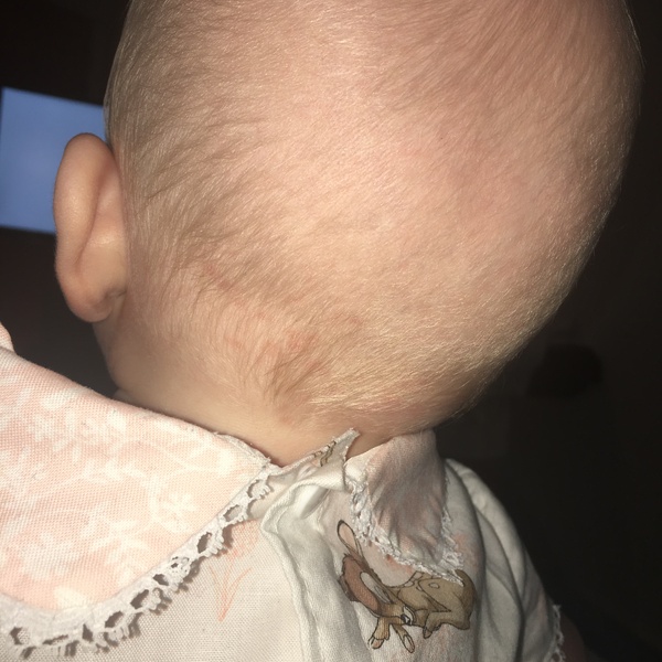 What are these spots?