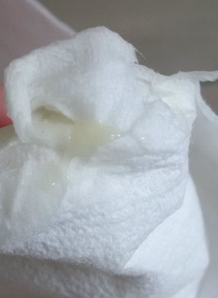 instead of period getting this (pic included)