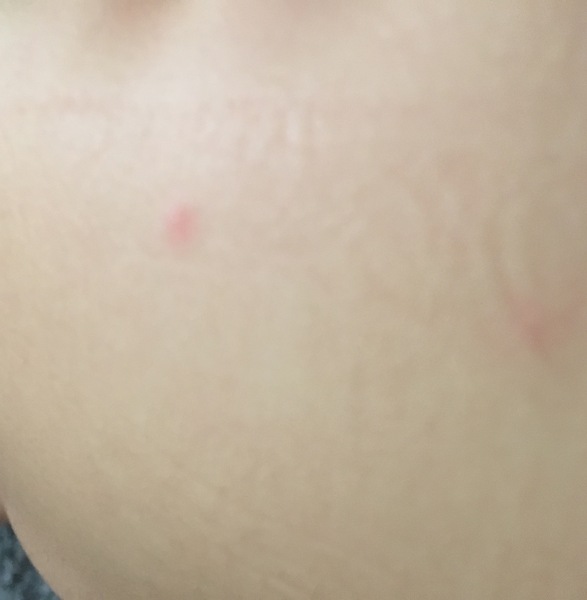 What are these spots?