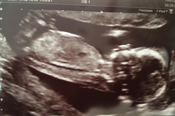 First Time Pregnancy (3)