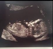 I want to trick my husband into having a baby.