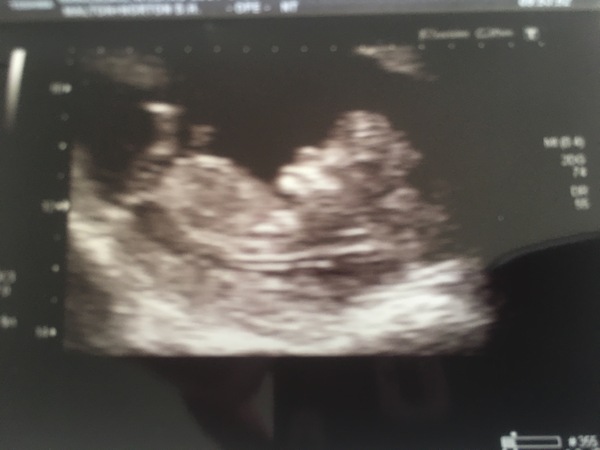 February 2018 Babies #2