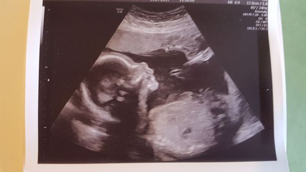 November 2017 #3: Flutters, bubbles and a proper bump!