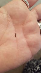 Worried about infection - too much googling