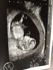 Anyone want to guess baby sex?