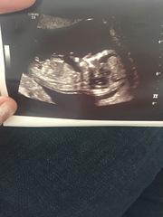 I think somethings happened to the baby and I have to wait until Monday to find out.
