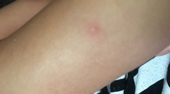 What are these spots?