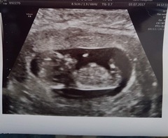 Gender guesses?!