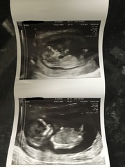 Gender guess 13 weeks
