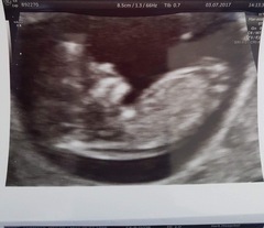 Gender guesses?!