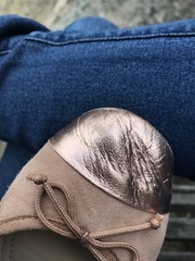 Faulty shoes or expected wear and tear