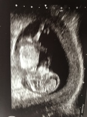 Anyone want to guess baby sex?